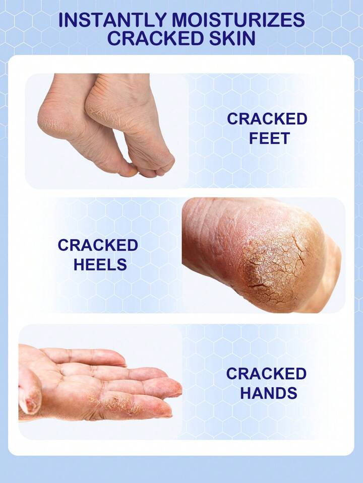 Salicylic Acid Moisturizing Foot Stick